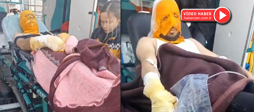 Erzincan’da Trafo Patlaması: 2 Aras Edaş Personeli Yaralandı
