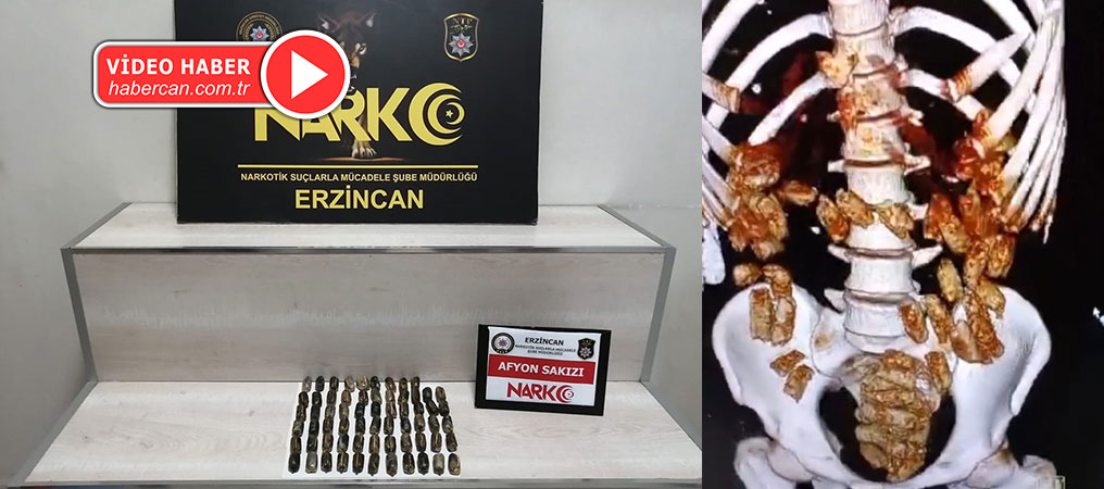 Midesinde 711 gram  Uyuşturucu Taşıyan İran’lı Kurye Yakalandı