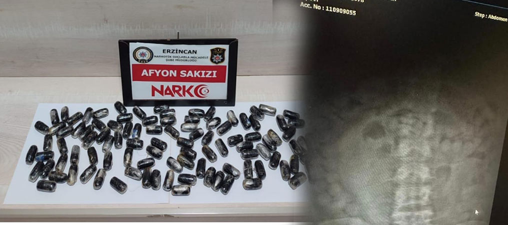 Midesinde Afyon Sakızı Taşıyan İran Uyruklu Kurye Tutuklandı