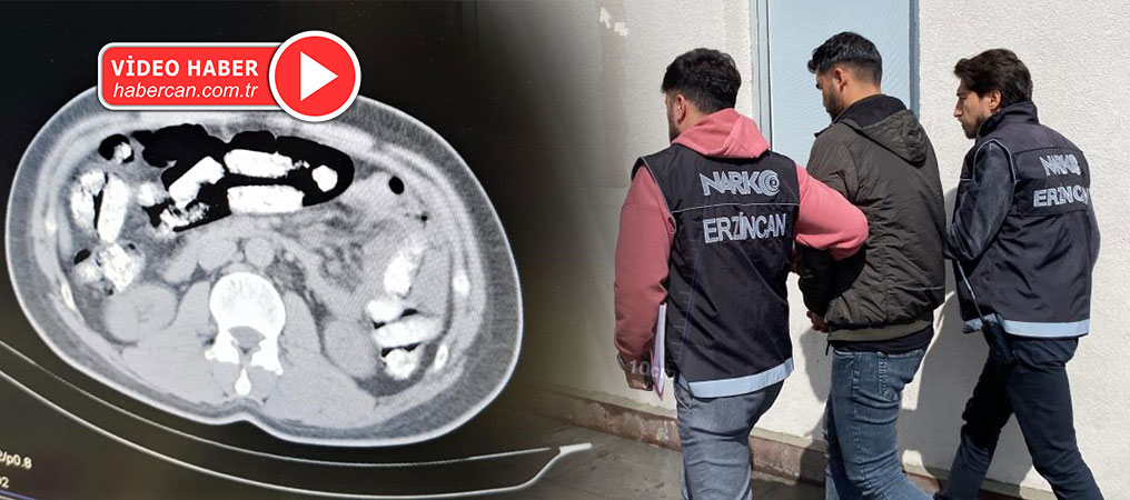 Midesinde Uyuşturucu Sevkiyatı Yaptı! 