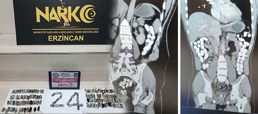 İranlı Uyuşturucu Kuryelerinin Midesinden 2 Kilo Uyuşturucu Çıktı